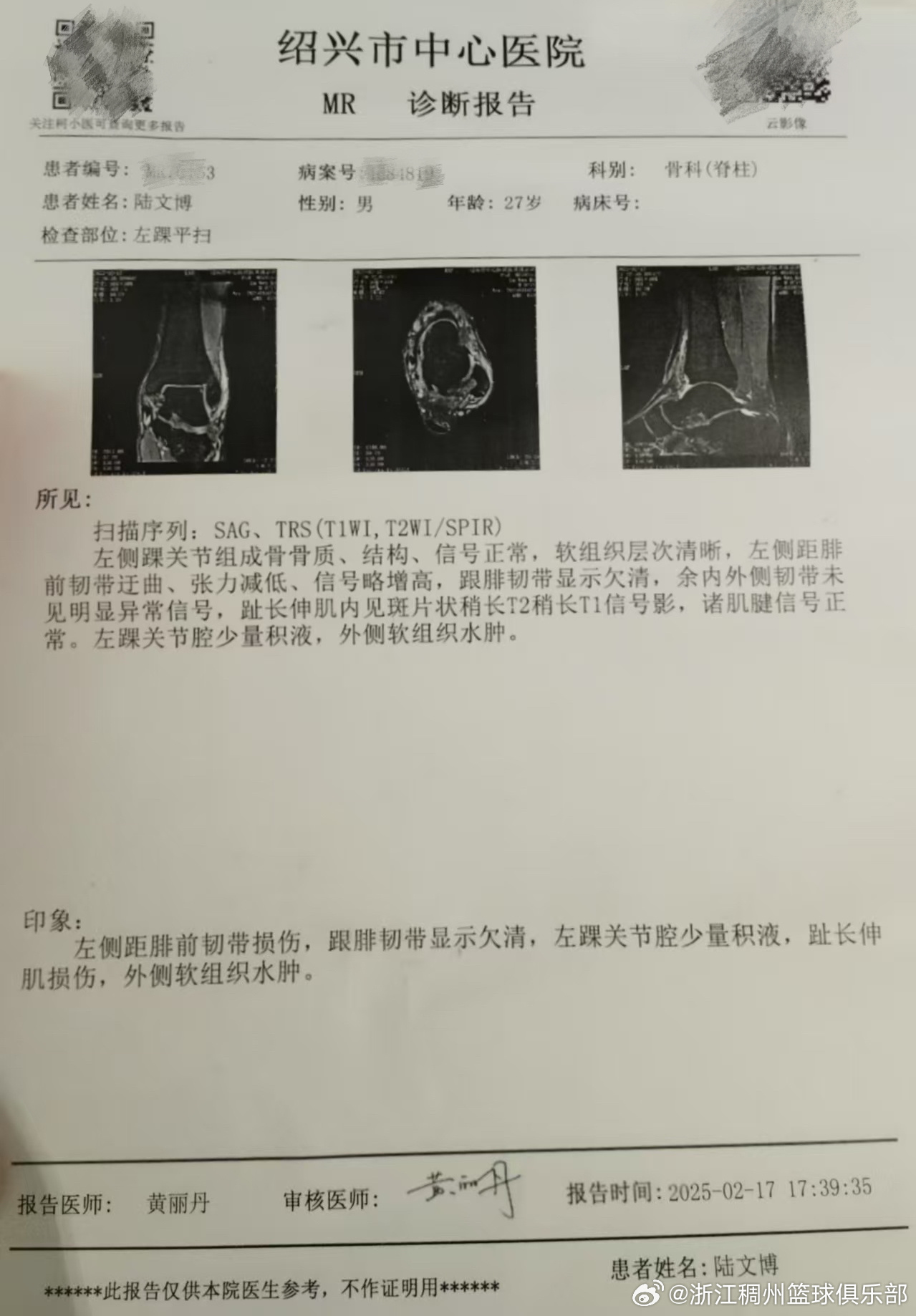 能掀起體壇
